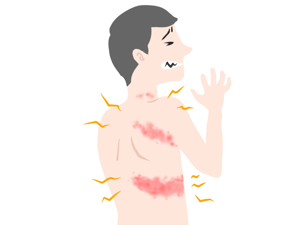 帯状疱疹の男性イメージ